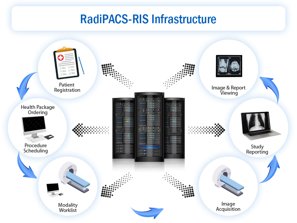 Radiply ris